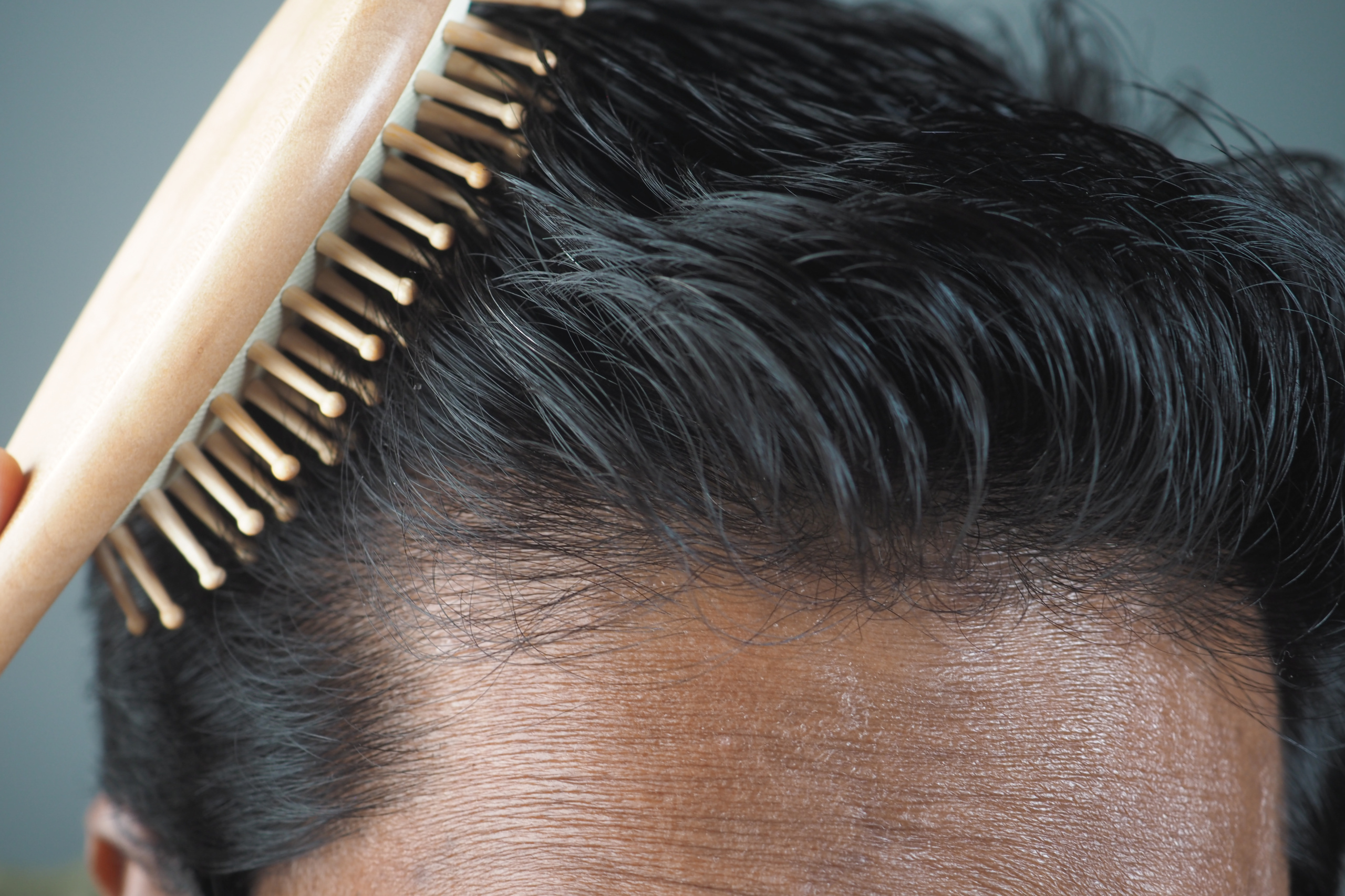 Hair Restoration