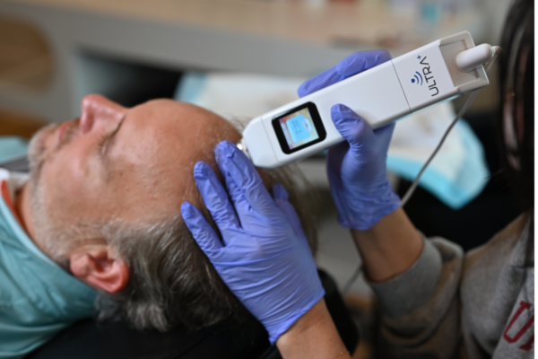 Advanced Hair Treatments at PRIMETIME Men's Clinic