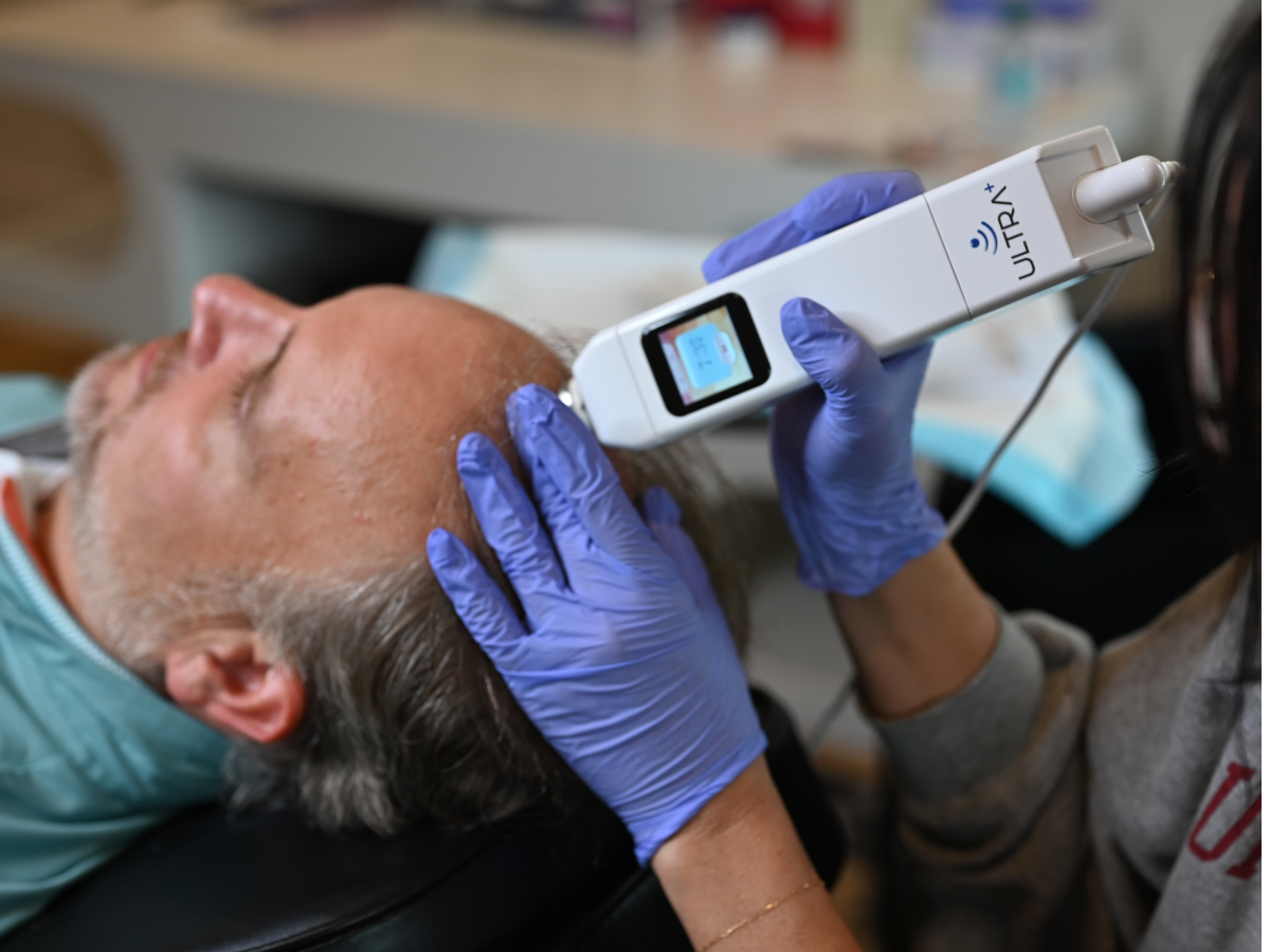 Advanced Hair Treatments at PRIMETIME Men's Clinic