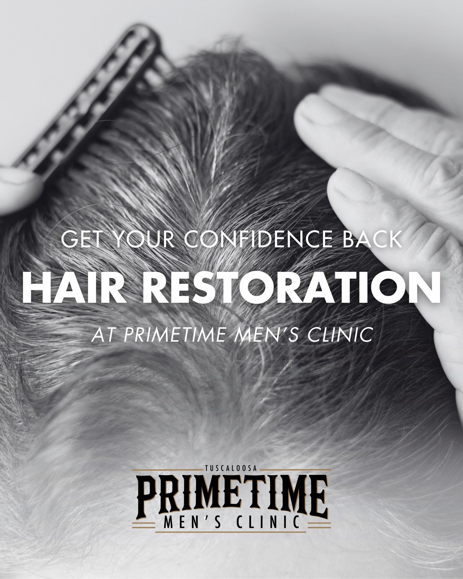 Hair restoration services at PrimeTime Men’s Clinic Northport, AL Hair restoration services at PrimeTime Men’s Clinic Northport, AL