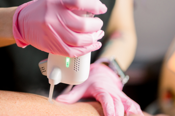 Laser Hair Removal at PRIMETIME Men's Clinic in Tuscaloosa,AL