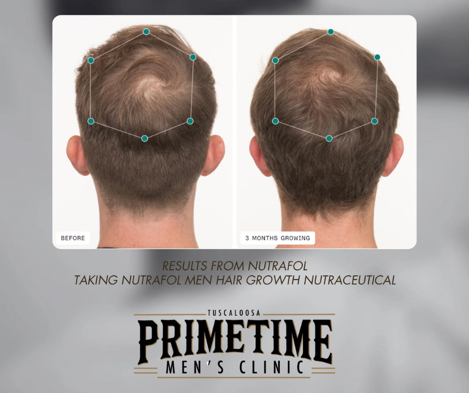 Real men and Real Results at PrimeTime Men's Clinic in Northport, AL