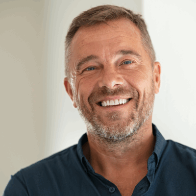 Hair Restoration for Men