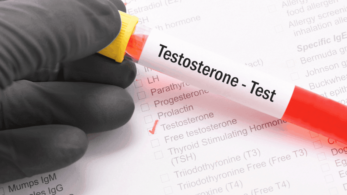 Testosterone Therapy in Tuscaloosa
